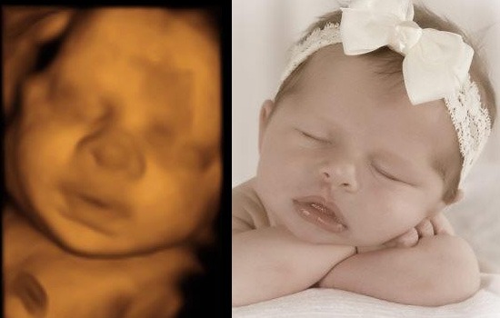 Baby Studio