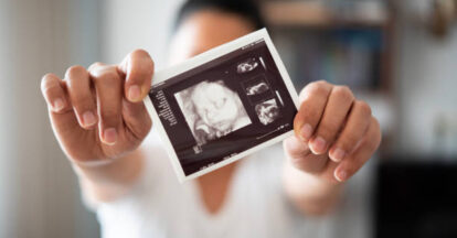 3D & 4D Ultrasounds