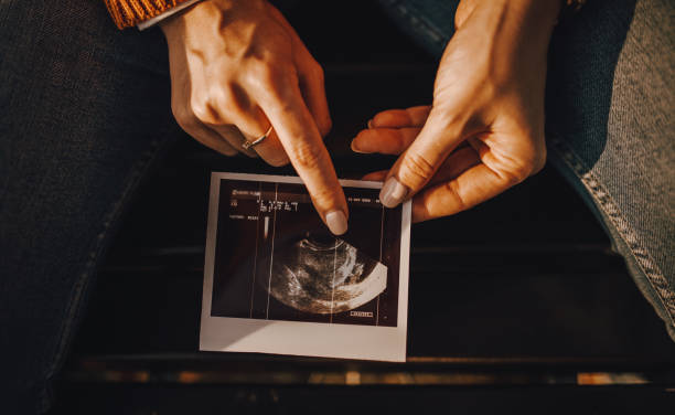 Early Gender Scan:
